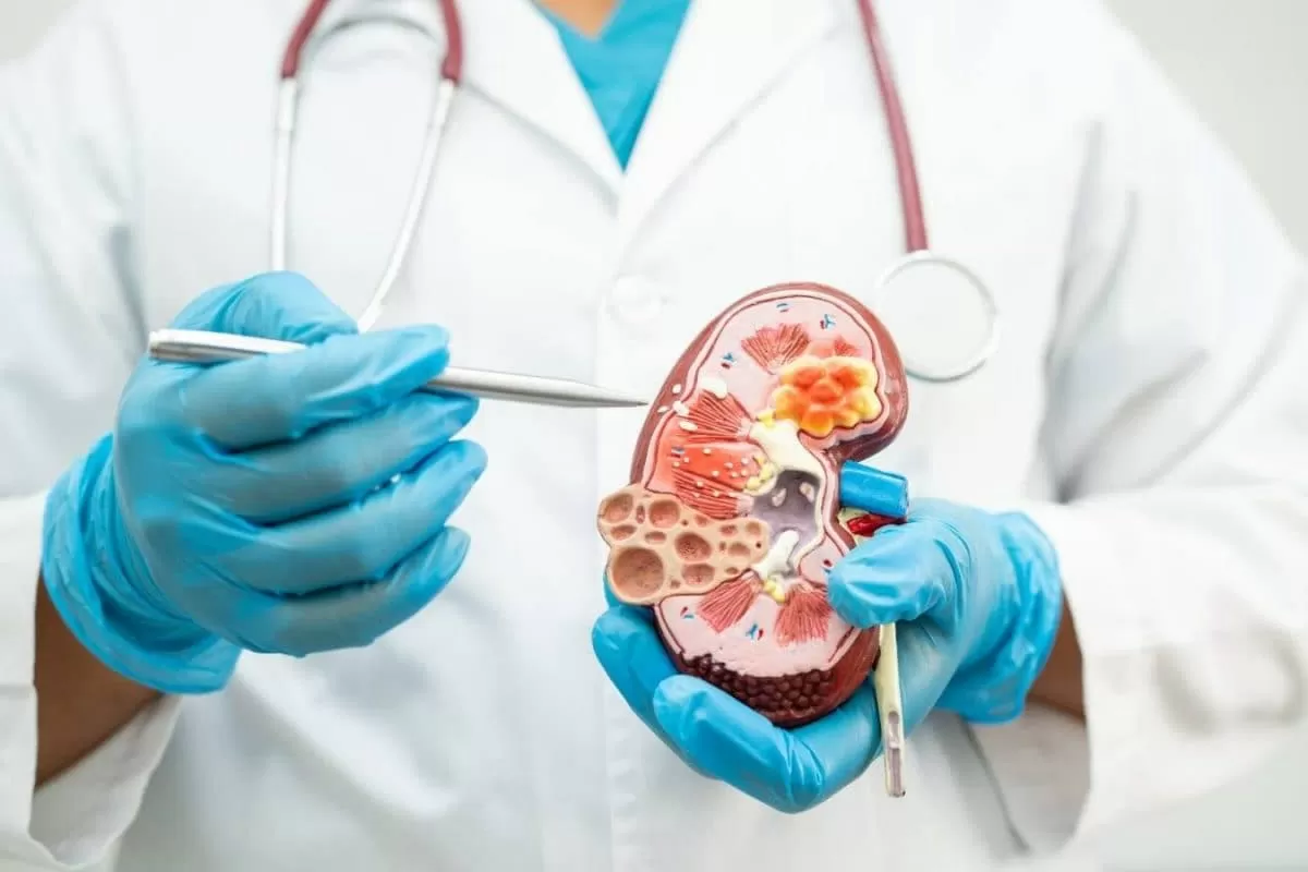 World Kidney Day: Expert Shares Important Things To Remember For Healthy Kidneys