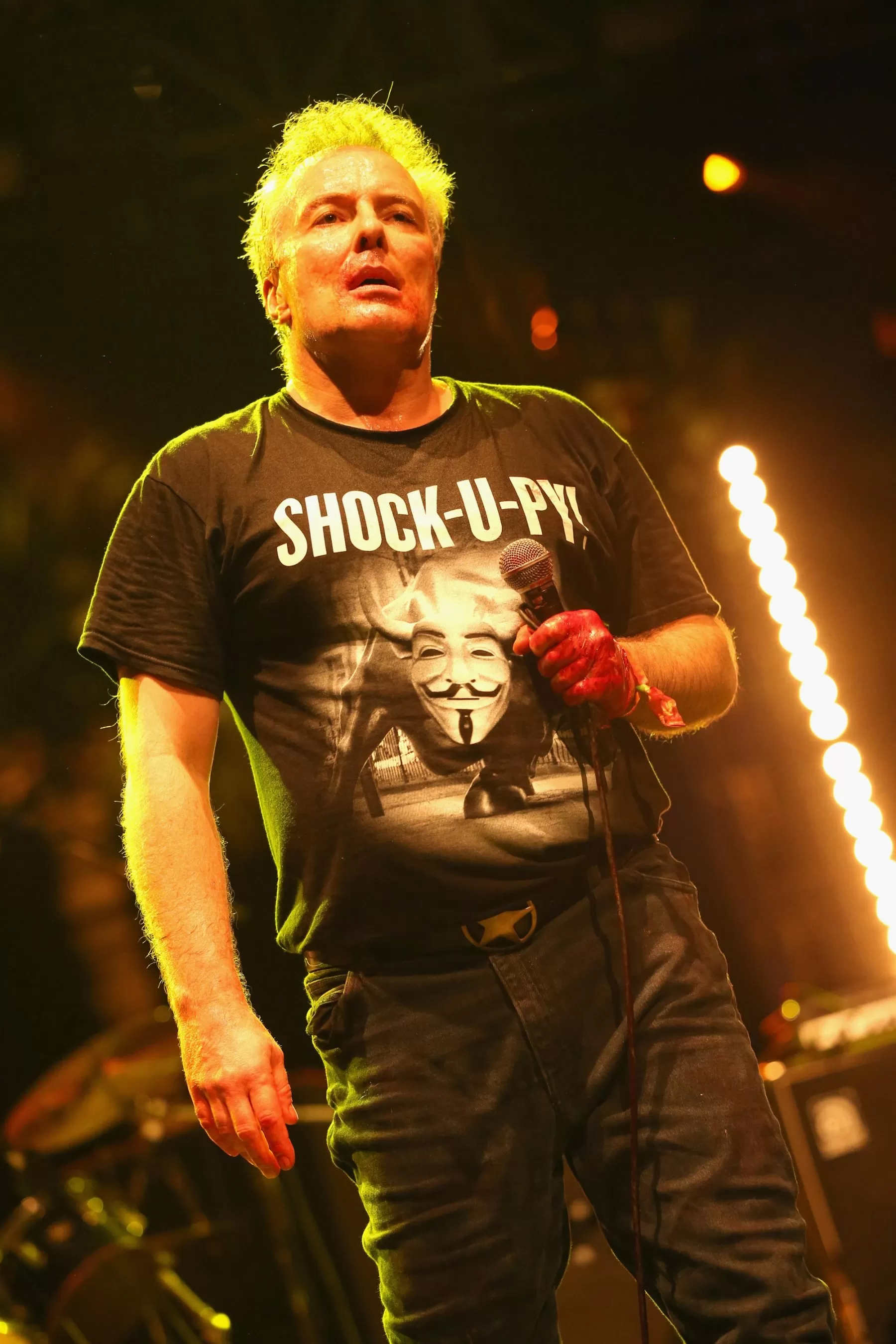 Former Dead Kennedys Singer Jello Biafra Hospitalized Following Hemorrhagic Stroke